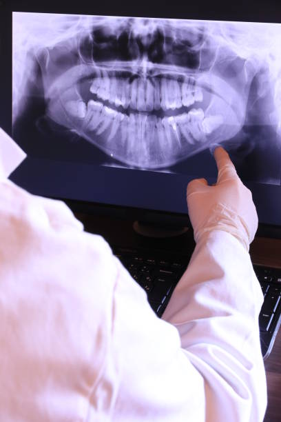 Best Emergency Dental Care for Broken or Chipped Teeth in Green Village, NJ